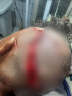 Polícia apura lesão corporal gravíssima após ataque de cachorro