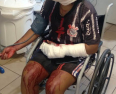 Mulher é ferida a golpes de facão e quase tem a mão decepada em aldeia