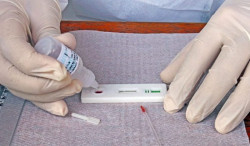 Em sete dias, MS tem 330 novos casos de covid e cinco mortes