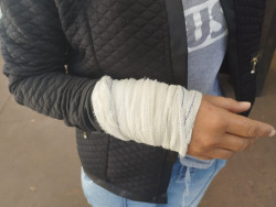 Mulher denuncia vizinho por ataque de cachorro em Dourados