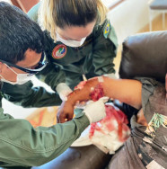 Peão é atacado por onça no Pantanal e tem fraturas expostas